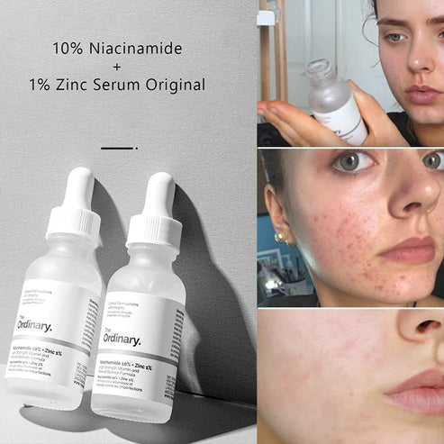 The Ordinary Niacinamide 10% + Zinc 1% Serum – Oil Control & Blemish Care (30ml)