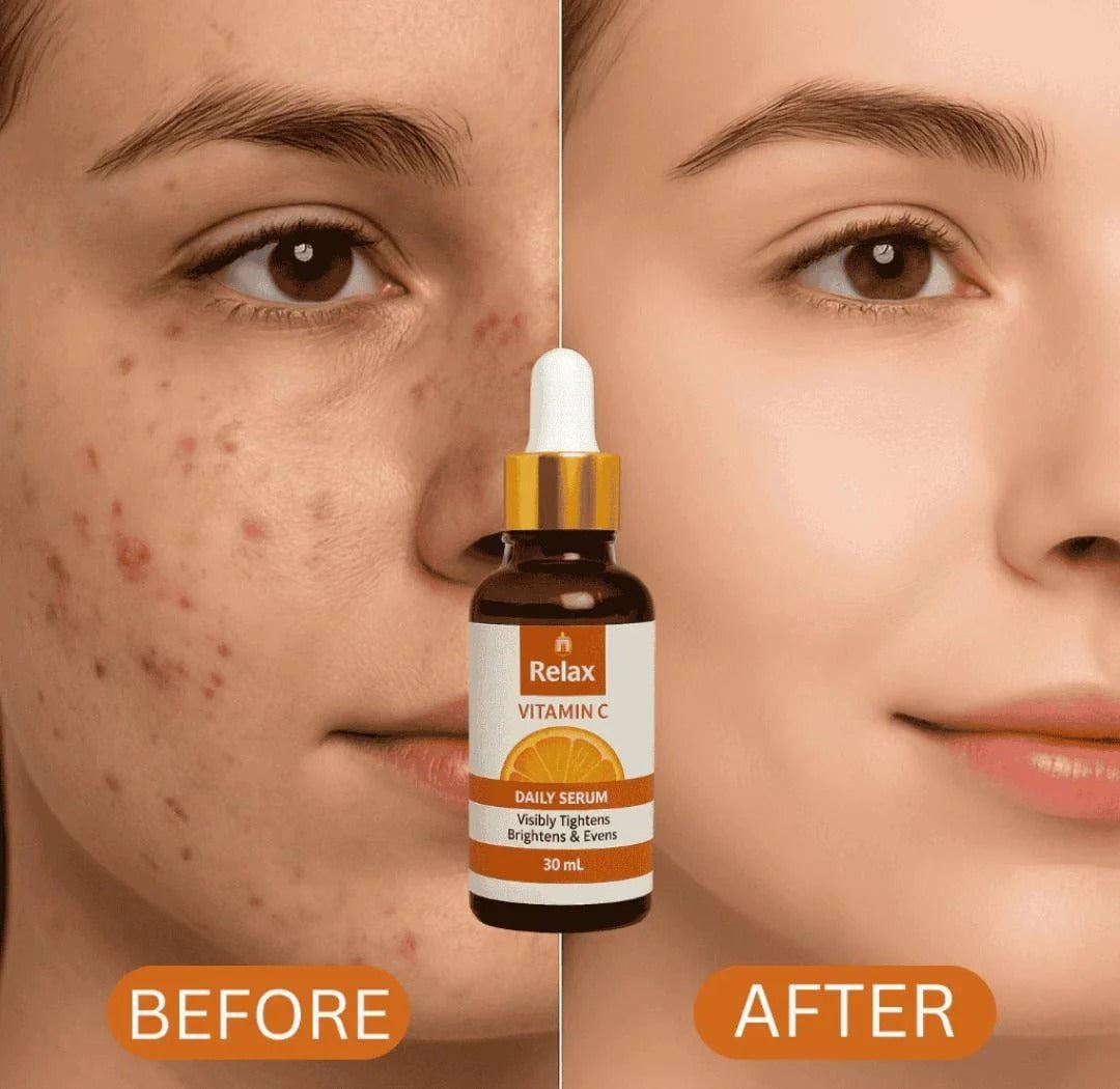 Relax Vitamin C Daily Serum – 30ml | Brightens Skin, Evens Tone & Reduces Signs of Aging