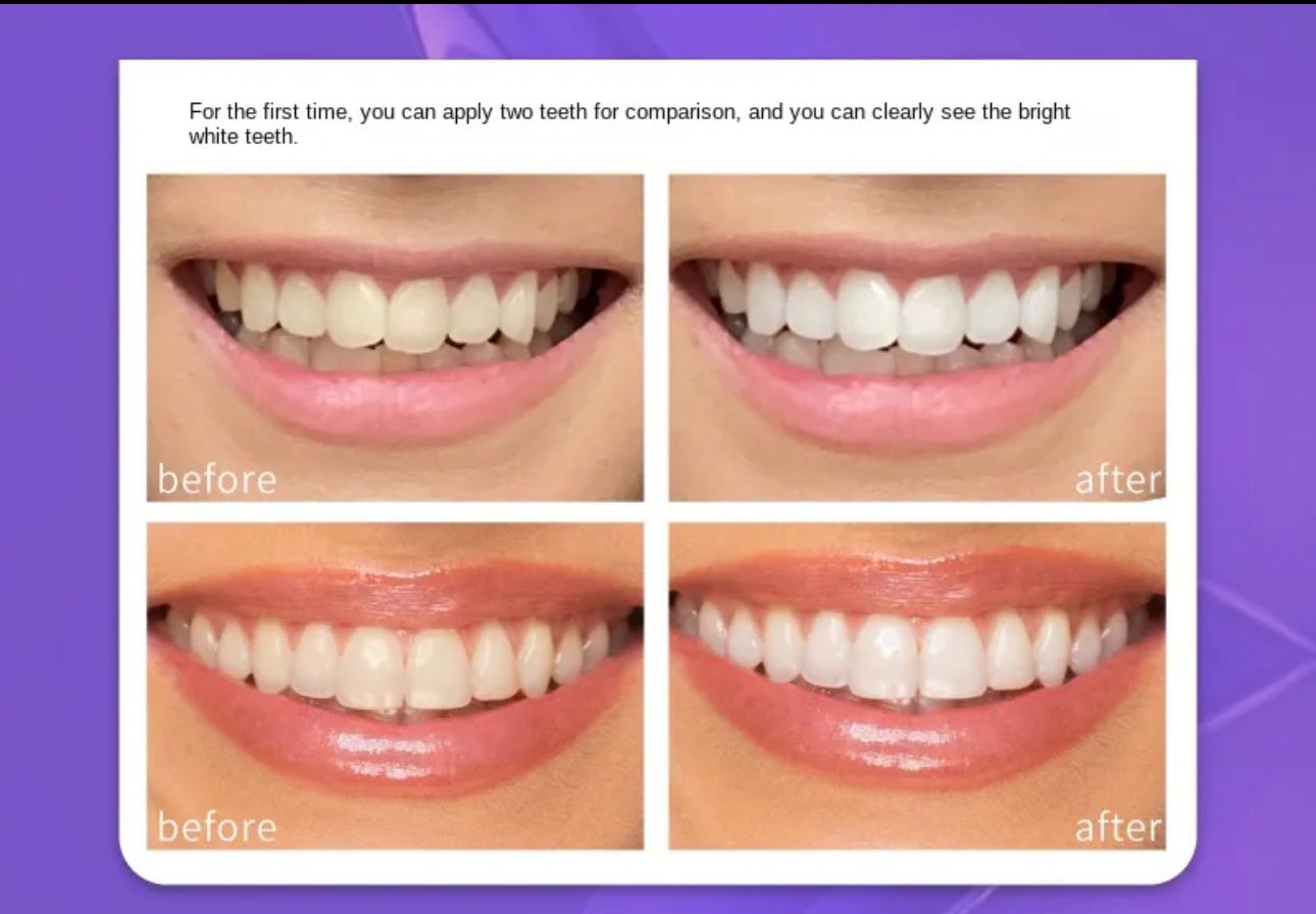 Hismile V34 Teeth Colour Corrector Serum 30ml | Instant Teeth Brightening | Purple Serum
